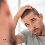 ماینوکسیدیل آلوپکسی ۵٪ | فروشگاه https://u-fitpro.com