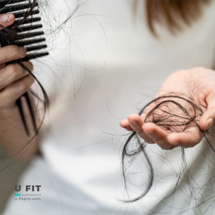 ماینوکسیدیل آلوپكسى ٢٪؜ | Alopexy Minoxidil 2% - Image 4