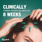 ماینوکسیدیل ۲٪ مردان و زنان روگین | فروشگاه https://u-fitpro.com