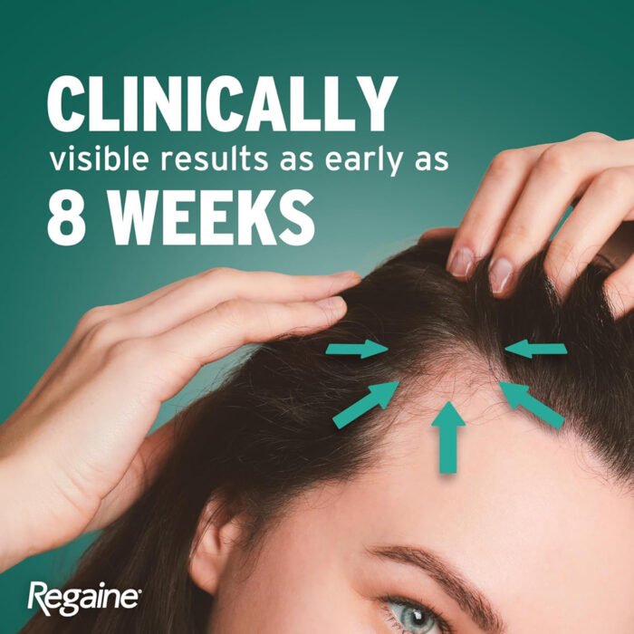 ماینوکسیدیل ۲٪ مردان و زنان روگین | فروشگاه https://u-fitpro.com