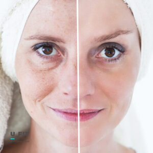 ان ای دی (NAD) یا ناد چیست ؟ | فروشگاه https://u-fitpro.com