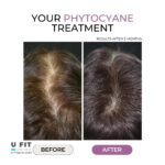 فیتو سیان مکمل ضد ریزش مو | فروشگاه https://u-fitpro.com/