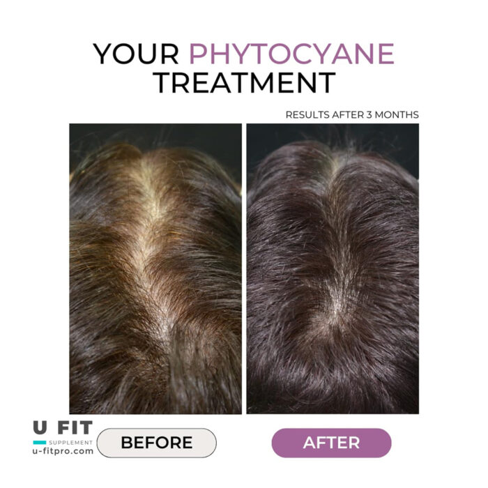 فیتو سیان مکمل ضد ریزش مو | فروشگاه https://u-fitpro.com/